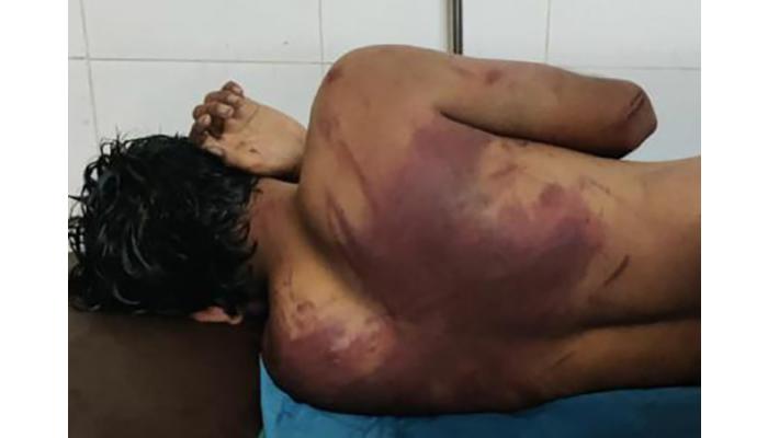 फलटणमध्ये अल्पवयीन मुलाचे अपहरण करुन पाठीवर वळ उठेपर्यंत मारहाण