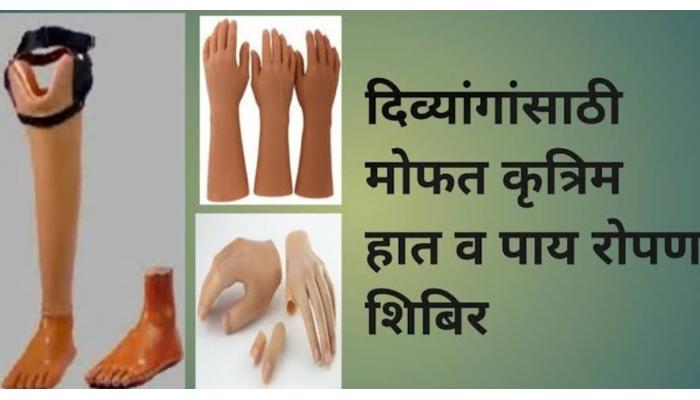 दिव्यांग व्यक्तींना कृत्रिम हात पाय बसविण्यासाठी शिबीरांचे आयोजन