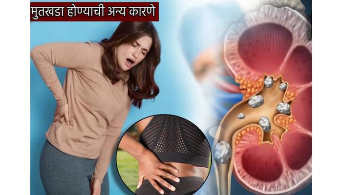 चहा प्यायल्याने किडनी स्टोन होतो किडनीवरचा वाढतो ताण?