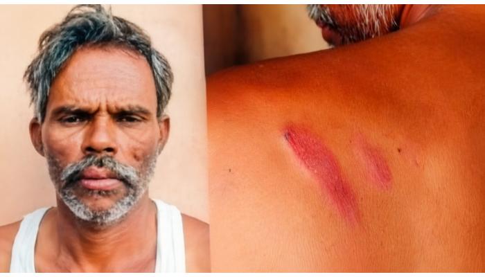 सुपने येथे बिबट्याच्या हल्ल्यात शेतकरी जखमी; वनविभागाकडे पिंजरा लावण्याची मागणी