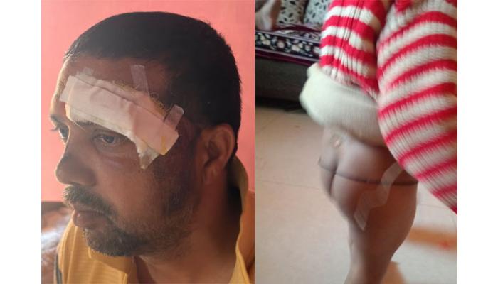 वानरांचा उपद्रवाने मांढरदेवीकर नागरिक त्रस्त; वानरांचा बंदोबस्त करण्याची मागणी